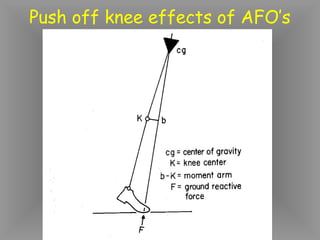 Push off knee effects of AFO’s
 