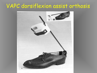 VAPC dorsiflexion assist orthosis
 