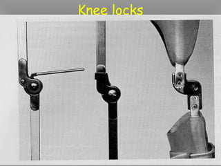 Knee locks
 