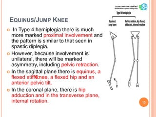 EQUINUS/JUMP KNEE
 In Type 4 hemiplegia there is much
more marked proximal involvement and
the pattern is similar to that seen in
spastic diplegia.
 However, because involvement is
unilateral, there will be marked
asymmetry, including pelvic retraction.
 In the sagittal plane there is equinus, a
flexed stiff€knee, a flexed hip and an
anterior pelvic tilt.
 In the coronal plane, there is hip
adduction and in the transverse plane,
internal rotation. 13
GaitAbnormalitiesinCP
 