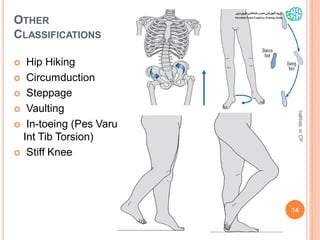 OTHER
CLASSIFICATIONS
 Hip Hiking
 Circumduction
 Steppage
 Vaulting
 In-toeing (Pes Varus,
Int Tib Torsion)
 Stiff Knee
14
GaitAbnormalitiesinCP
 