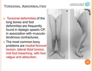 TORSIONAL ABNORMALITIES
 Torsional deformities of the
long bones and foot
deformities are frequently
found in diplegic spastic CP,
in association with musculo-
tendinous contractures.
 The most common bony
problems are medial femoral
torsion, lateral tibial torsion,
mid foot breaching, with foot
valgus and abduction.
45
GaitAbnormalitiesinCP
 
