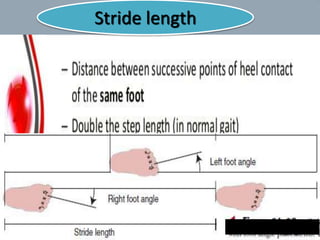 Stride length
20
 
