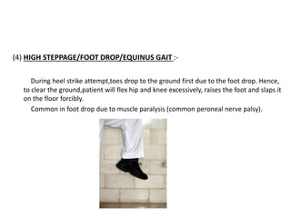 (4) HIGH STEPPAGE/FOOT DROP/EQUINUS GAIT :-
During heel strike attempt,toes drop to the ground first due to the foot drop. Hence,
to clear the ground,patient will flex hip and knee excessively, raises the foot and slaps it
on the floor forcibly.
Common in foot drop due to muscle paralysis (common peroneal nerve palsy).
 