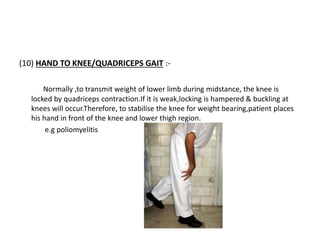 (10) HAND TO KNEE/QUADRICEPS GAIT :-
Normally ,to transmit weight of lower limb during midstance, the knee is
locked by quadriceps contraction.If it is weak,locking is hampered & buckling at
knees will occur.Therefore, to stabilise the knee for weight bearing,patient places
his hand in front of the knee and lower thigh region.
e.g poliomyelitis
 