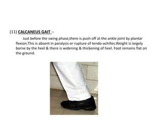 (11) CALCANEUS GAIT :-
Just before the swing phase,there is push off at the ankle joint by plantar
flexion.This is absent in paralysis or rupture of tendo-achilles.Weight is largely
borne by the heel & there is widening & thickening of heel. Foot remains flat on
the ground.
 
