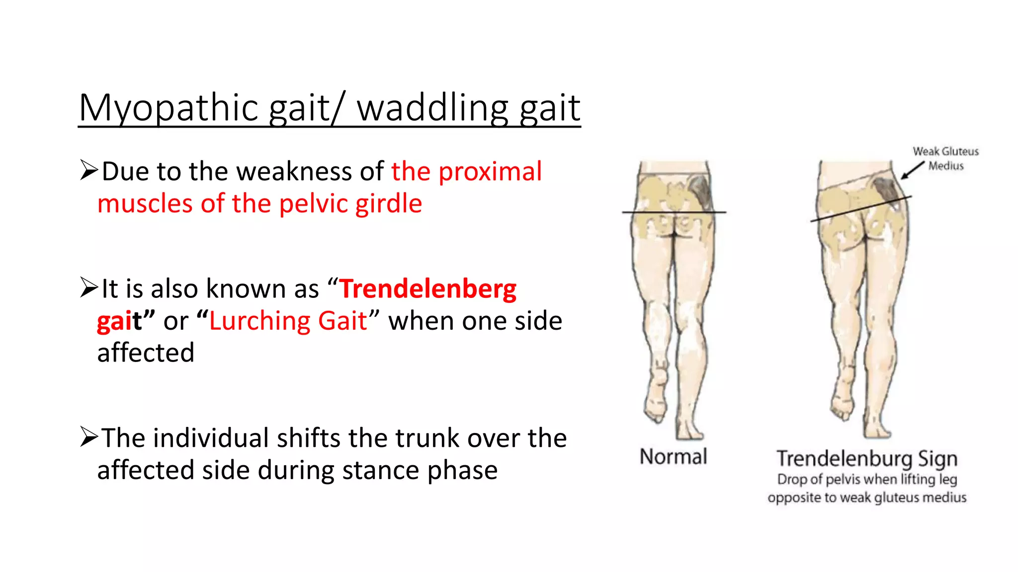 Gait Seminar.pptx, image size:2048x1152