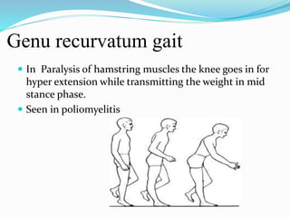 Genu recurvatum gait
 In Paralysis of hamstring muscles the knee goes in for
hyper extension while transmitting the weight in mid
stance phase.
 Seen in poliomyelitis
 