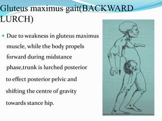 Gluteus maximus gait(BACKWARD
LURCH)
 Due to weakness in gluteus maximus
muscle, while the body propels
forward during midstance
phase,trunk is lurched posterior
to effect posterior pelvic and
shifting the centre of gravity
towards stance hip.
 