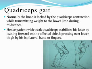 Gait | PPT