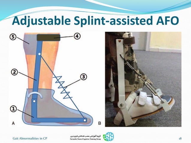Gait training in children with cp | PDF