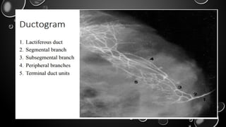 Dactography Types GALACTOGRAPHYY PRESENTATION in Radiology .pptx