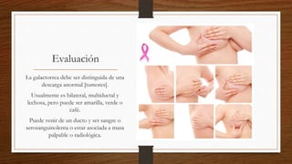 Evaluación
La galactorrea debe ser distinguida de una
descarga anormal [tumores].
Usualmente es bilateral, multiductal y
lechosa, pero puede ser amarilla, verde o
café.
Puede venir de un ducto y ser sangre o
serosanguinolenta o estar asociada a masa
palpable o radiológica.
 
