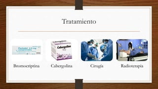 Tratamiento
Bromocriptina Cabergolina Cirugía Radioterapia
 