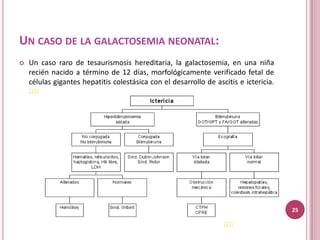 UN CASO DE LA GALACTOSEMIA NEONATAL:
   Un caso raro de tesaurismosis hereditaria, la galactosemia, en una niña
    recién nacido a término de 12 días, morfológicamente verificado fetal de
    células gigantes hepatitis colestásica con el desarrollo de ascitis e ictericia.
    (16)




                                                                                       25

                                                                   (17)
 