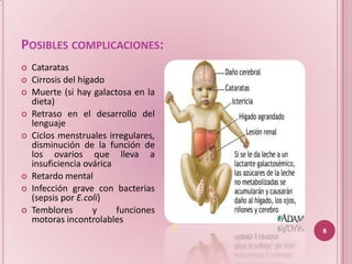POSIBLES COMPLICACIONES:
   Cataratas
   Cirrosis del hígado
   Muerte (si hay galactosa en la
    dieta)
   Retraso en el desarrollo del
    lenguaje
   Ciclos menstruales irregulares,
    disminución de la función de
    los ovarios que lleva a
    insuficiencia ovárica
   Retardo mental
   Infección grave con bacterias
    (sepsis por E.coli)
   Temblores        y    funciones
    motoras incontrolables
                                      (5)
                                            8
 