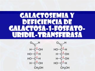 Galactosemia y deficiencia de galactosa-1-fosfato-uridil-transferasa  