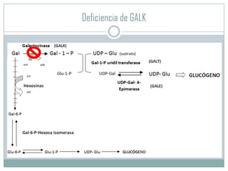 Deficiencia de GALK

 