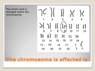 The chromosome is affected is
The amino acid is
changed within the
chromosome.
 