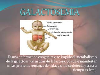 Es una enfermedad congénita que impide el metabolismo
de la galactosa, un azúcar de la lactosa. Se suele manifestar
en las primeras semanas de vida, y si no se detecta y trata a
tiempo es letal.
 