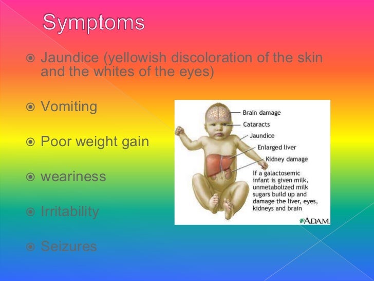 Galactosemia ppt