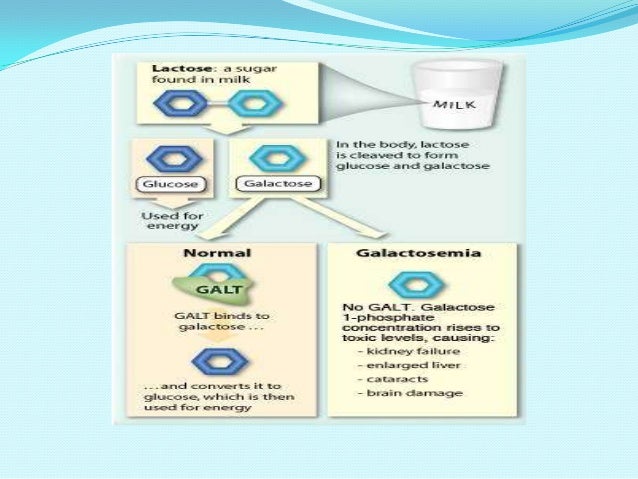 Galactosemia