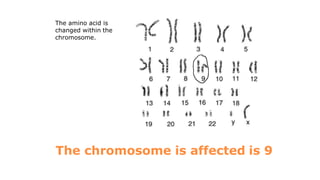 The chromosome is affected is 9
The amino acid is
changed within the
chromosome.
 