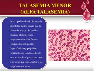 Galactosemia y talasemia | PPT