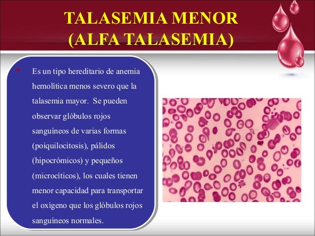alfa talasemia menor pdf alfa talasemia menor pdf