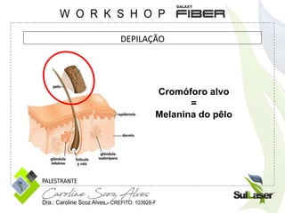 DEPILAÇÃO
Cromóforo alvo
=
Melanina do pêlo
 