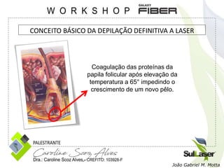 Coagulação das proteínas da
papila folicular após elevação da
temperatura a 65° impedindo o
crescimento de um novo pêlo.
João Gabriel M. Motta
CONCEITO BÁSICO DA DEPILAÇÃO DEFINITIVA A LASER
 