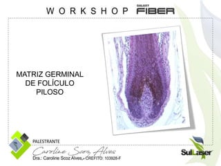 MATRIZ GERMINAL
DE FOLÍCULO
PILOSO
 