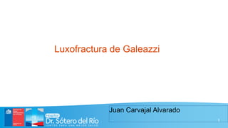 1
Luxofractura de Galeazzi
Juan Carvajal Alvarado
 