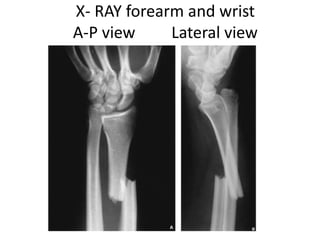 X- RAY forearm and wrist
A-P view Lateral view
 