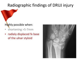Radiographic findings of DRUJ injury
 