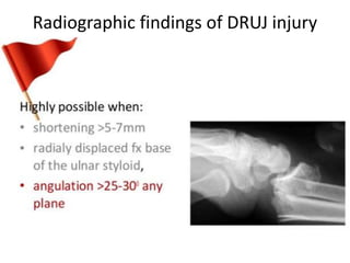 Radiographic findings of DRUJ injury
 