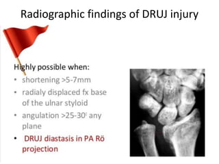 Radiographic findings of DRUJ injury
 