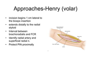 Approaches-Henry (volar)
• incision begins 1 cm lateral to
the biceps insertion
• extends distally to the radial
styloid
• Interval between
brachioradialis and FCR
• Identify radial artery and
superficial radial n.
• Protect PIN proximally
 