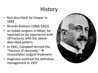 History
• first described by Cooper in
1842
• Ricardo Galeazzi (1866-1952)
• an Italian surgeon in Milan, he
reported on his experience with
18 fractures with the above-
described pattern
• In 1941, Campbell termed the
"fracture of necessity," 
necessitates surgical treatment
• Hughston outlined the definitive
management in 1957
 