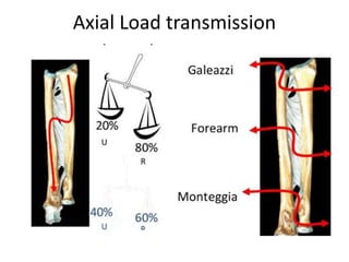 Axial Load transmission
 