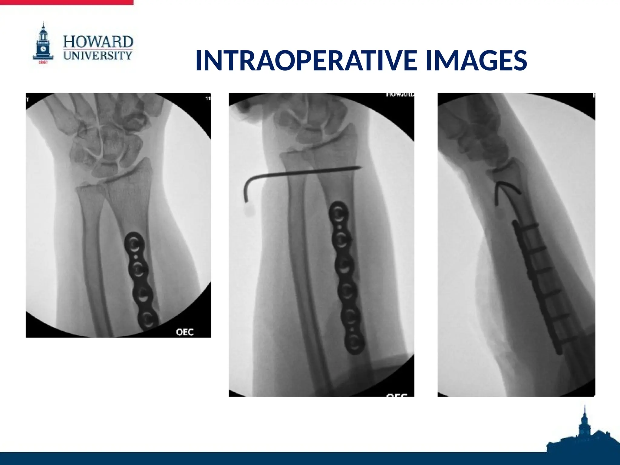 INTRAOPERATIVE IMAGES
 
