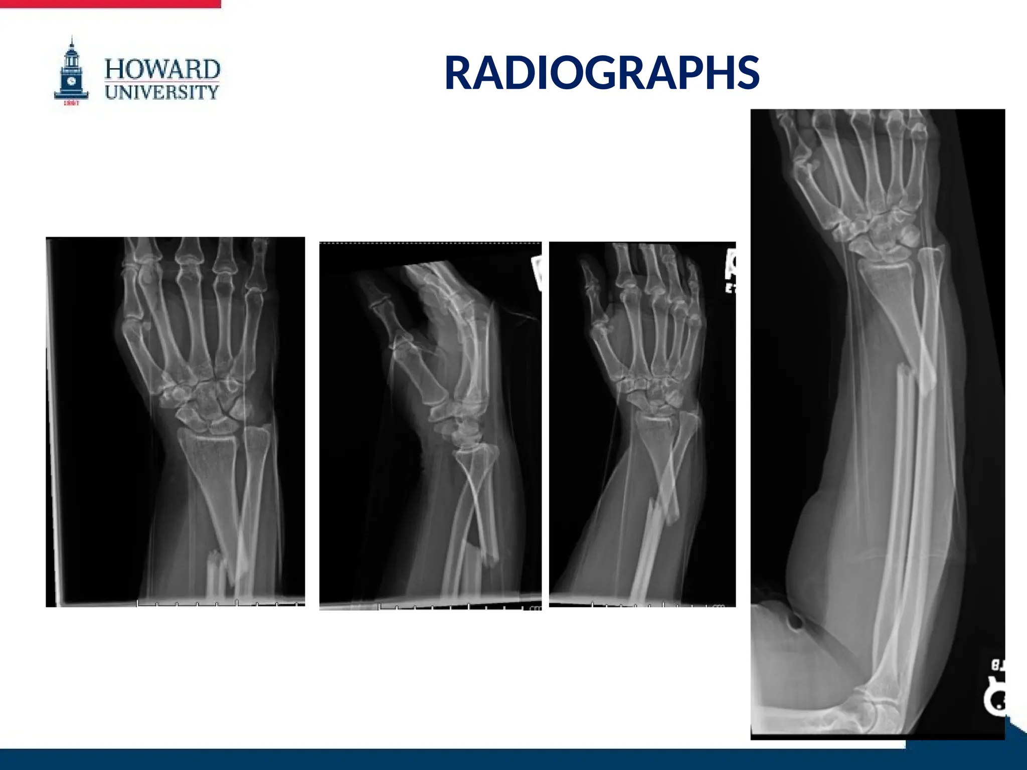 RADIOGRAPHS
 