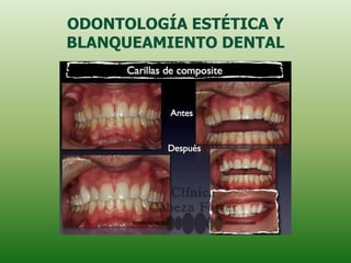 ODONTOLOGÍA ESTÉTICA Y
BLANQUEAMIENTO DENTAL
 
