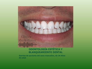 ODONTOLOGÍA ESTÉTICA Y
          BLANQUEAMIENTO DENTAL
Sonrisa de paciente del sexo masculino, de 26 Años
de edad
 