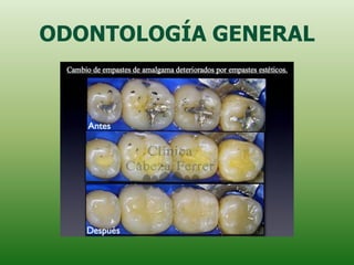 ODONTOLOGÍA GENERAL
 