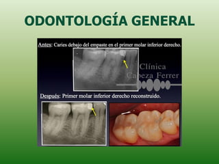 ODONTOLOGÍA GENERAL
 