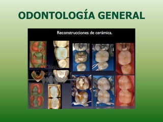 ODONTOLOGÍA GENERAL
 