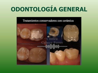 ODONTOLOGÍA GENERAL
 