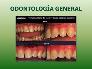 ODONTOLOGÍA GENERAL
 