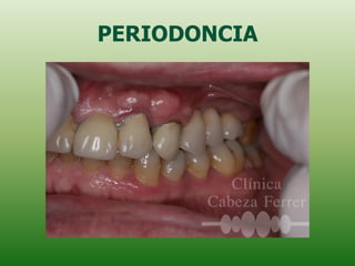 PERIODONCIA
 